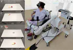 To Reach the Unreachable: Exploring the Potential of VR Hand Redirection for Upper Limb Rehabilitation